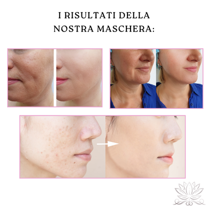 Maschera Bloom - Terapia a Luci Rosse